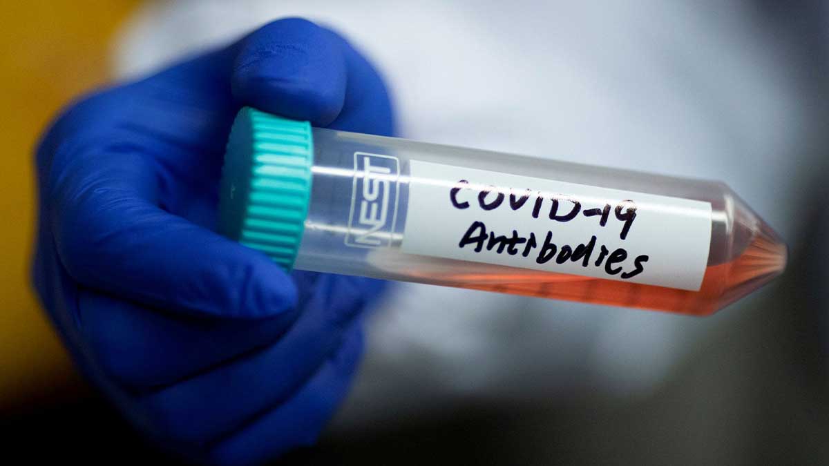 Covid antibodies