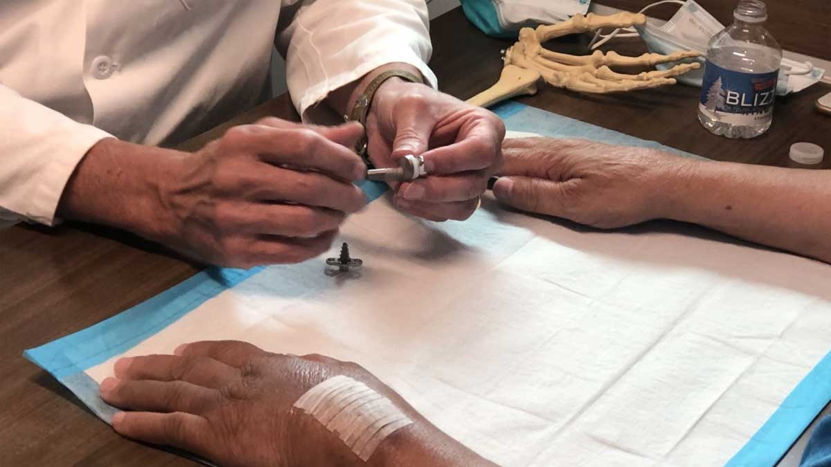 wrist replacement