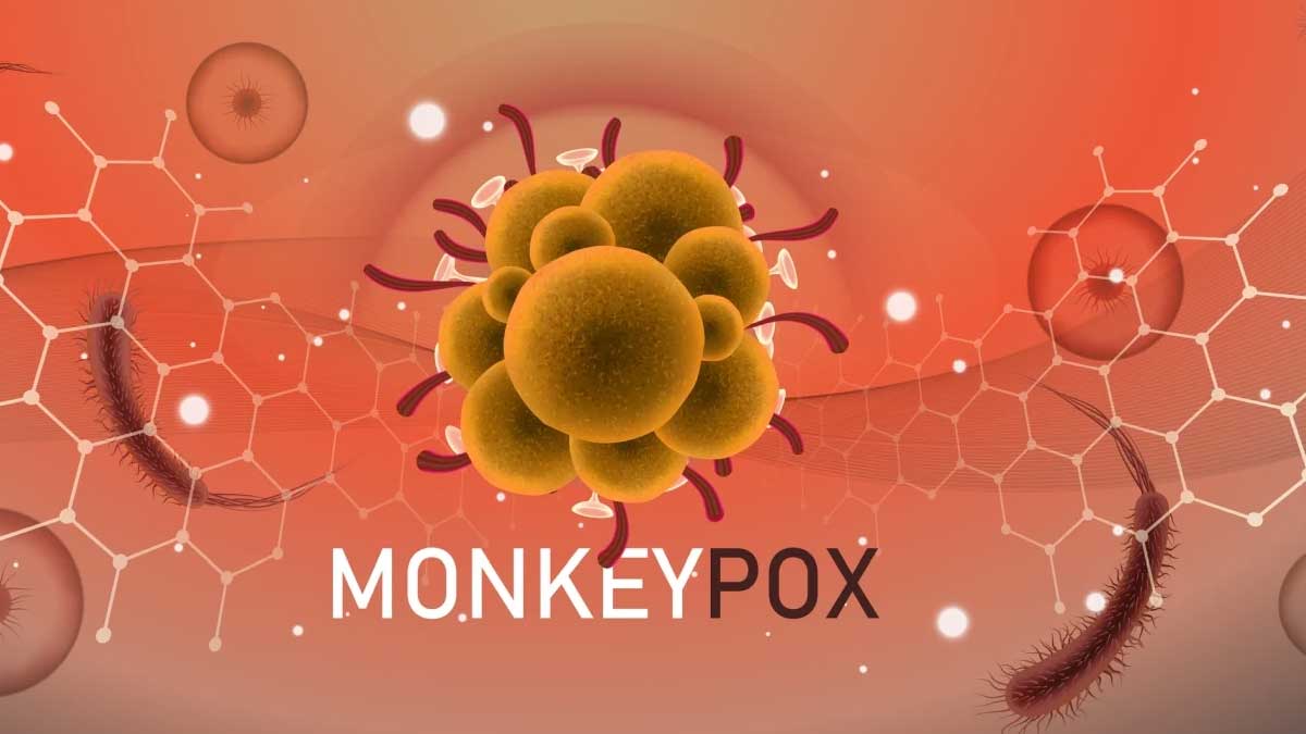 monkeypox