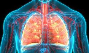 Lung cancer is the third most common cancer in the United States, with the highest mortality rate, according to the Centers for Disease Control and Prevention.