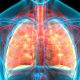 Lung cancer is the third most common cancer in the United States, with the highest mortality rate, according to the Centers for Disease Control and Prevention.